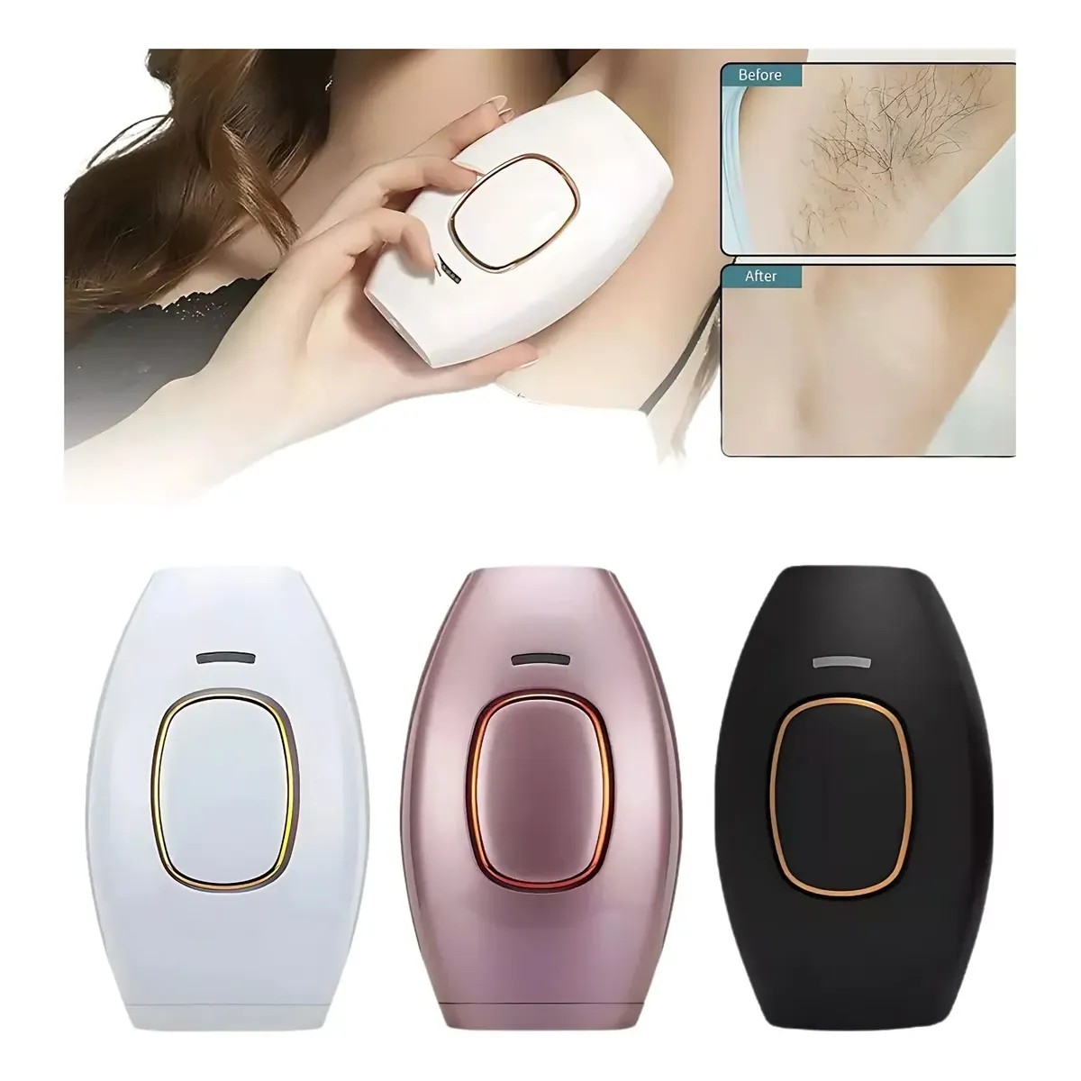 Depiladora Definitiva Ipl/laser Genérica Ipl - Imagen 9