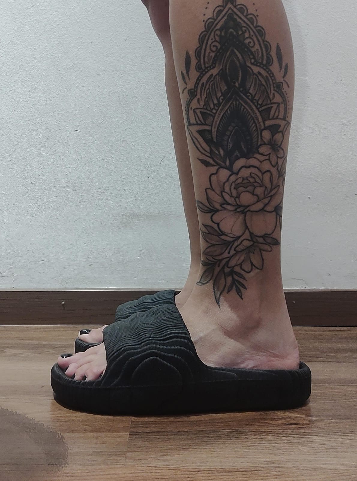 Art Ainda. Inyectado - Imagen 3