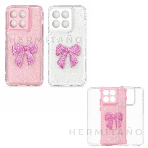 Case Moño 360